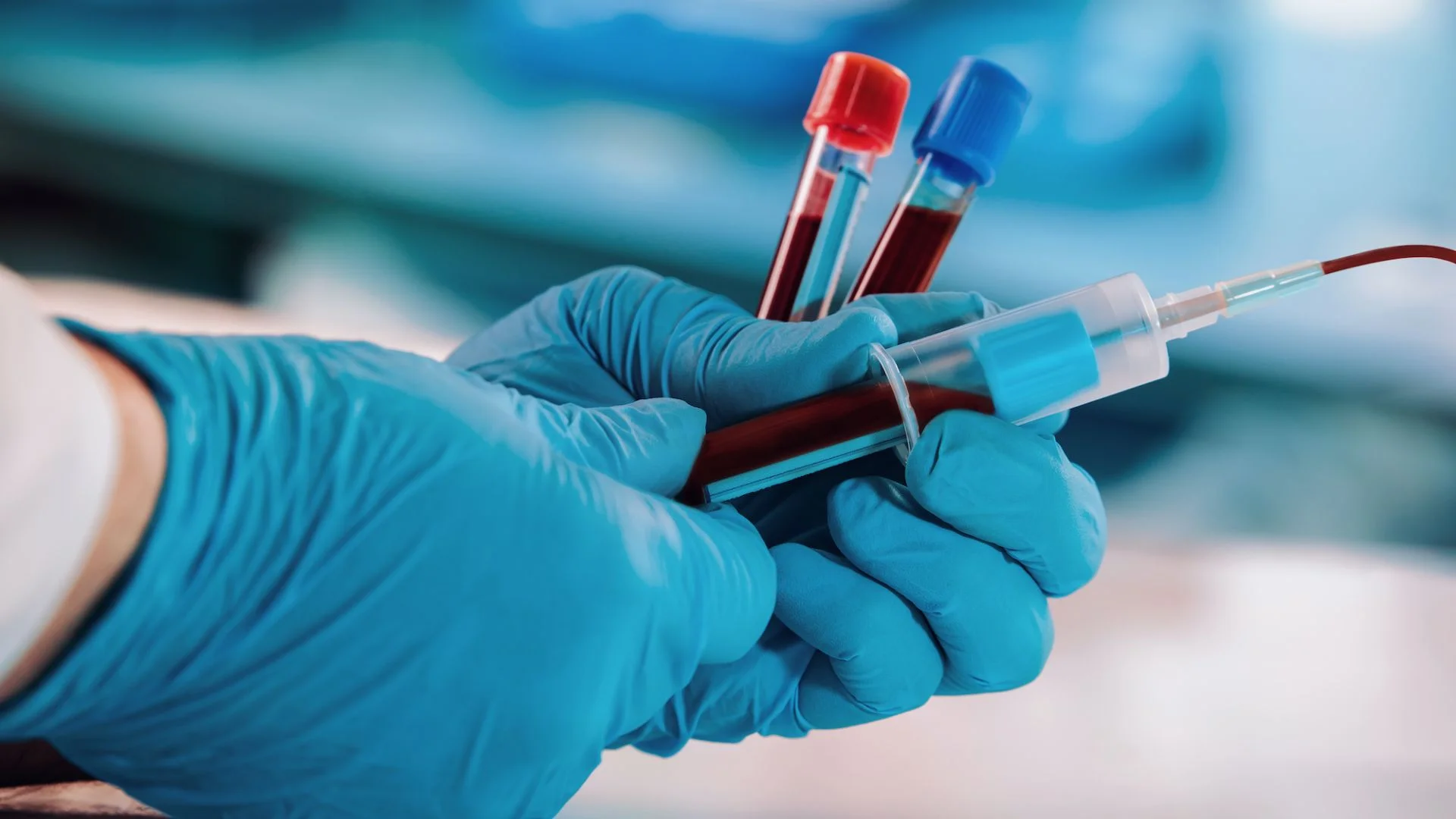 blood test home service Dubai